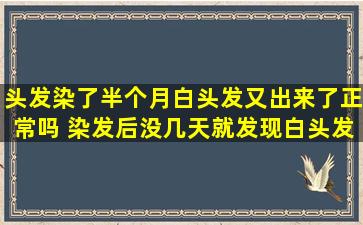 头发染了半个月白头发又出来了正常吗 染发后没几天就发现白头发了怎么办